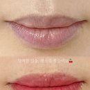 더모먼트 이미지