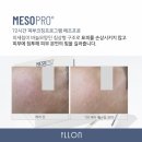 피부관리콜 이미지