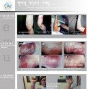 호주산 에뮤오일(EMU OIL) 에 대해서... 이미지