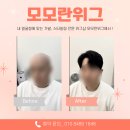 처음 쓰는 남자가발, 모모란위그로 선택한 이유는 티 안나는 비밀