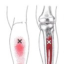 우리들재활의학과의원 이미지