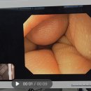 스코프 컨넥션 이미지