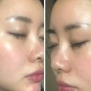 아진종합광고 | 부산 주사피부염으로 피부과 세곳 다녀와보고 쓰는 일기