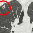 매일 ‘비둘기’ 먹이 챙겨준 여성… 의사도 충격 받은 ‘엑스레이’ 사진 이미지