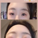 샛별안과의원 이미지