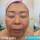 피부에설레다 이미지