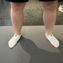 디포먼스 이미지