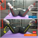 다이어트리스