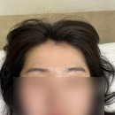 한끗 차이로 예뻐지기 헤어라인왁싱 오롯뷰티
