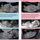 자매회 | 첫 임신 이야기 ☀️ 임신 초기 증상들, 입덧 시작 시기