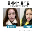 풀페이스의원 이미지