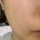 멜라토닝크림 약국 미백크림 사용후기