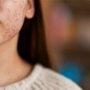 플로레스피부과의원 이미지