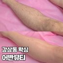 어반왁싱 | [대구/달서구] 어반뷰티 | 감삼동 남자 다리 왁싱 후기, 털 스트레스 해결 !