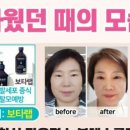 인셀덤 노블레스