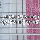 고은빛네일 | 임신4주(배란15일~18일차) 임신극초기증상 기록
