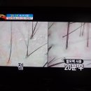 생초한의원 네이버블로그