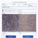 천인지한의원 | 당뇨 치료후기