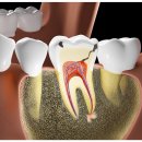 세라믹치과기공소 이미지
