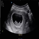 이즈맘산후조리원 이미지