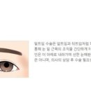 센트럴성형외과 이미지
