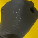 솔 | 대구 모공각화증 반월당등드름 솔에스테틱 후기