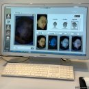 차앤박피부과의원 | [도곡양재 차앤박피부과] 리쥬란 주사 후기 공유해요.