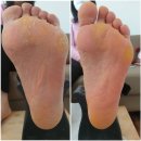 로제네일 이미지