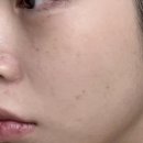 라미체피부관리실