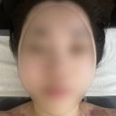 아라스킨케어 - 강서구 | 인천 검단 웨딩관리 | 윤곽관리샵 샤인스킨케어 11-15회차 후기