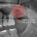 서울바른정치과 이미지