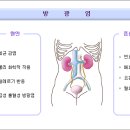 방광염 이미지