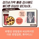 방아쇠수지증후군 운동: 진단과 치료 방법 [강서 류마내과의원]
