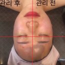 피부맑음 에스테틱 이미지