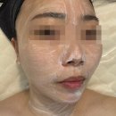 천안수기관리 천안잡티제거 불당동 피부관리 원장님의 손맛에 반한 : 330 바디앤스킨