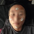 세븐일레븐대구동성로토요코인점 | 대구 문제성 피부 전문, 솔에스테틱, 대구 여드름압출
