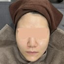 인천부평끗한의원 네이버블로그