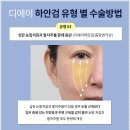 디에이솔루션