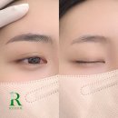 눈썹더하기 이미지