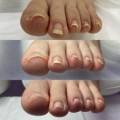 바미네일레푸스용인