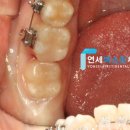 퍼스트치과기공소 이미지