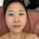 빛나는동안 | 윤곽관리] 이중턱과 긴 중안부 고민 해결하고 온 '빛나는 지금' 솔직 후기 (feat. 야탑얼굴관리 대만족)
