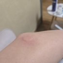 트리하우스 운서 이미지