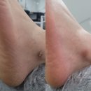 경화대동다숲경로당 | [진해 발관리 추천] 라움, 채우다 패디플래닝 솔직후기 (발 뒷굼치 관리 완전 만족)
