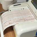5층 하늘약국 | [임신 출산] 유도분만 실패!! 응급제왕 제왕절개 출산 후기(과정,비용)