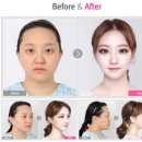 렛미인 이미지