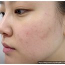리페어에스테틱 | 리페어에스테틱 울산점 화이트스피큘 울산피부관리 후기