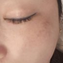 요즘 핫한 기미 영양제 누오 밀크톡 후기