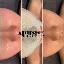 예쁠래에스테틱 이미지