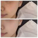 코엘뷰티 정관 | 1:1 프라이빗 피부관리 솔직 후기 🌿